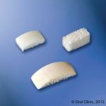 Bloc et plaquettes Implant-Dentaire-Pas-Cher-Espagne-Regeneration-Osseuse